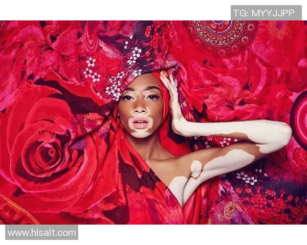 足球明星女友勇敢面对白癜风挑战展现坚强与美丽